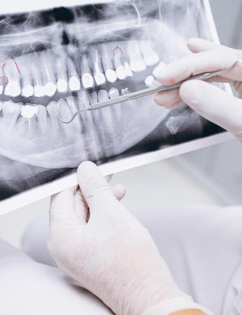 Dental implants consultation