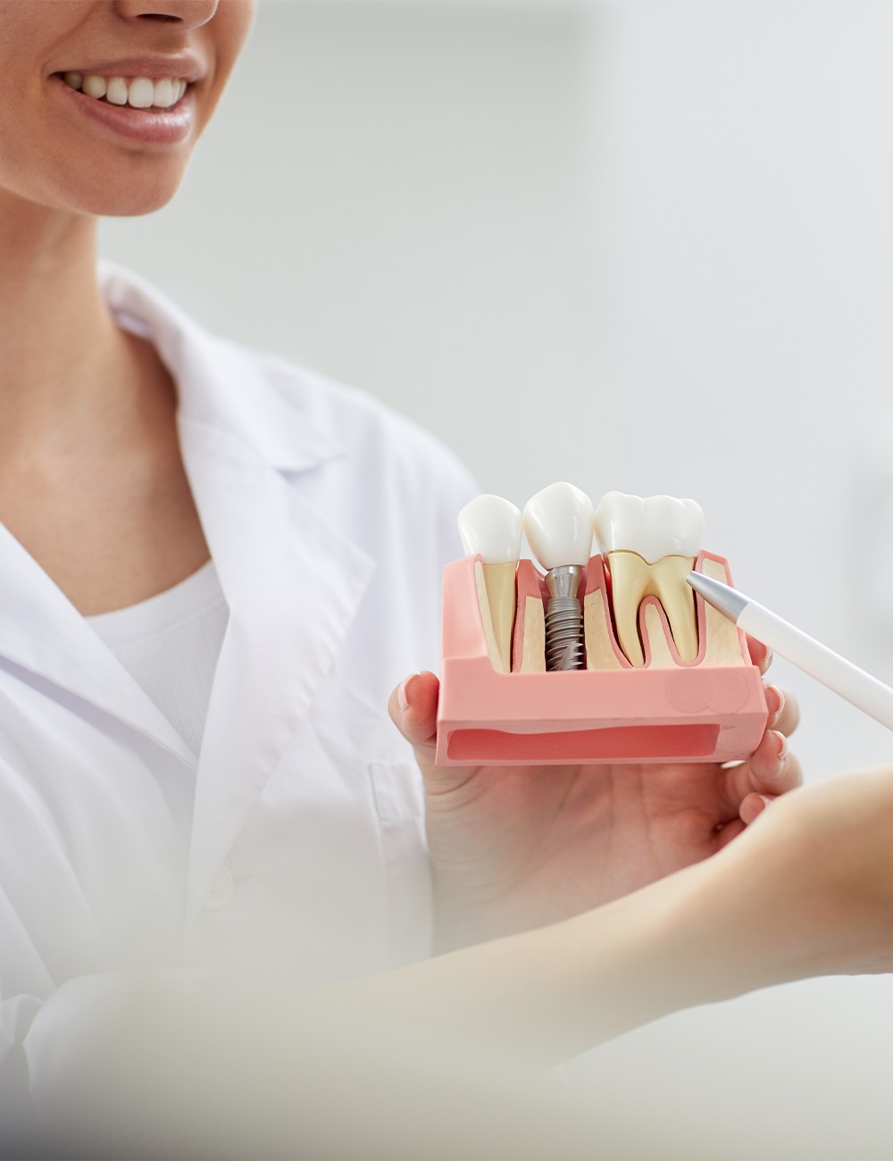 Healing and osseointegration phase