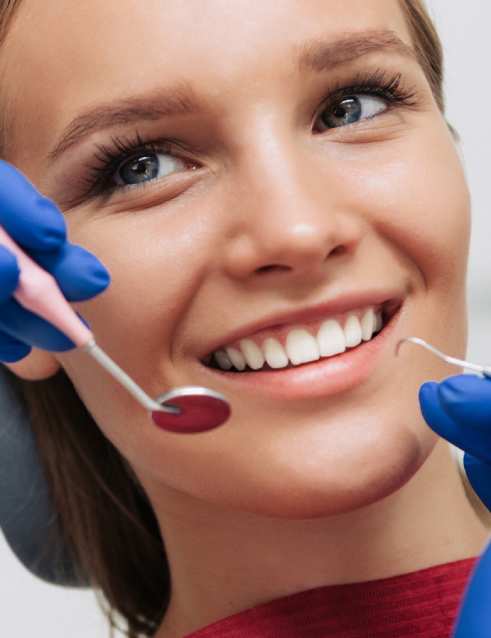 Follow-up visit after veneers placement