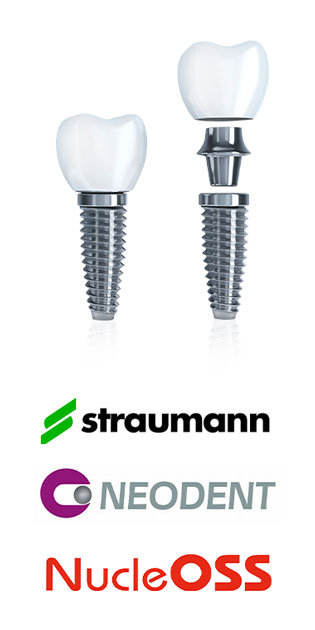 Implants img